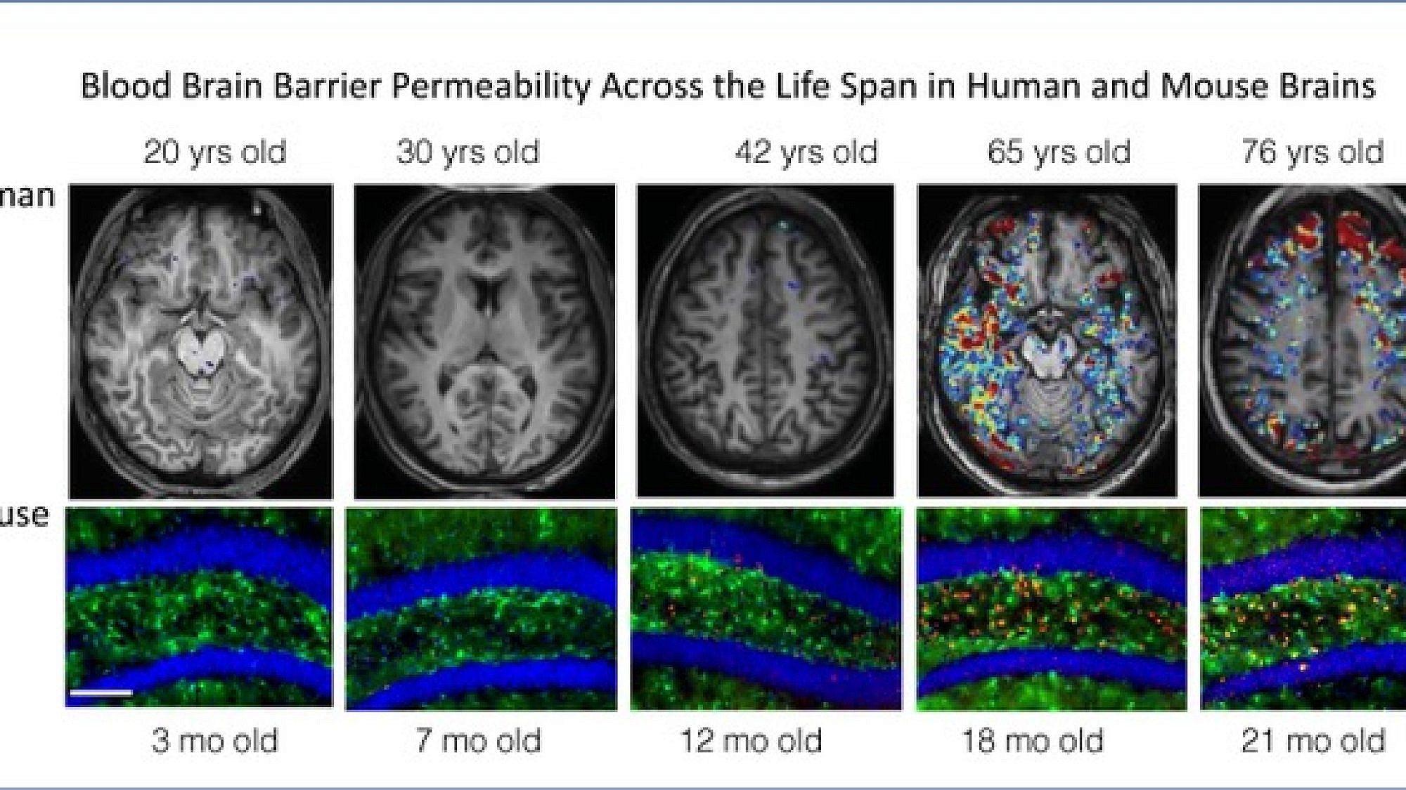 In mice and humans, the blood brain barrier becomes leaky with age. Researchers at Ben-Gurion University of the Negev and the University of California, Berkeley, have found new diagnostic ways to measure leaking and are developing a drug that can reverse the effects, and enhance cognitive ability with age. Credit: Courtesy.