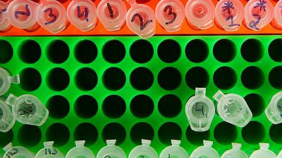 Tubes at a laboratory at Hadassah Hebrew University Medical Center in Jerusalem. Photo by Flash90.