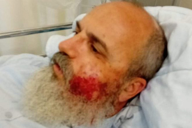 B'Sheva newspaper editor Emmanuel Shiloh recovering at Meir Medical Center in Kfar Saba, July 4, 2023. Source: Twitter.