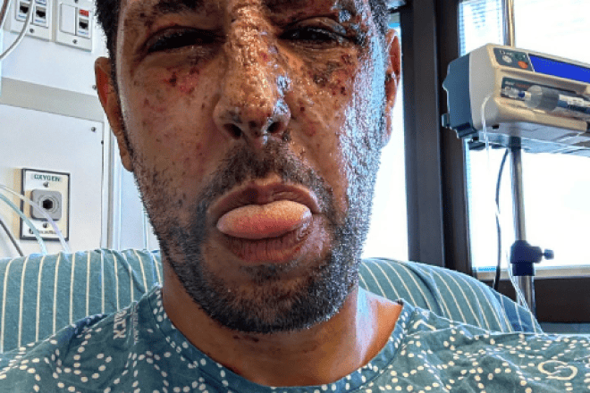 Israeli actor Idan Amedi shares a photo taken soon after he was wounded while fighting as a reservist soldier in the Israel Defense Forces against Hamas in the Gaza Strip, Feb. 20, 2024. Source: Instagram/@idan_amedi.