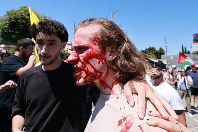 A supporter of Israel is helped up after clashing with pro-Palestinian protesters blocking access to the Adas Torah synagogue in Los Angeles, June 23, 2024. Photo by David Swanson/AFP via Getty Images.