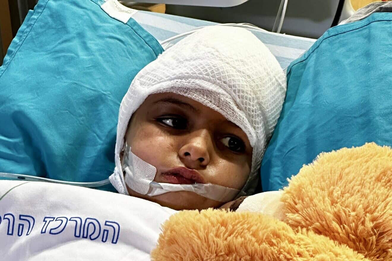 Amina Alhasoni, 7, was critically wounded in Iran's April 13 missile attack on the Jewish state. Credit: Courtesy.