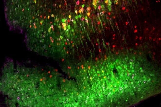 An α-synuclein protein spreading in a mouse brain. Credit: Tel Aviv University.